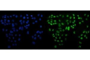 IF analysis of ATF6 using anti-ATF6 antibody (ABIN7601704).