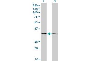 Western Blot analysis of CRSP8 expression in transfected 293T cell line by CRSP8 monoclonal antibody (M01), clone 8B8. (MED27 antibody  (AA 1-70))