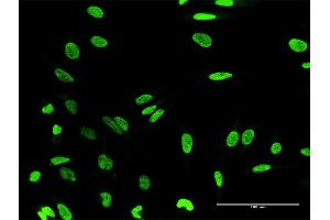 Immunofluorescence of purified MaxPab antibody to HN1L on HeLa cell. (HN1L antibody  (AA 1-190))