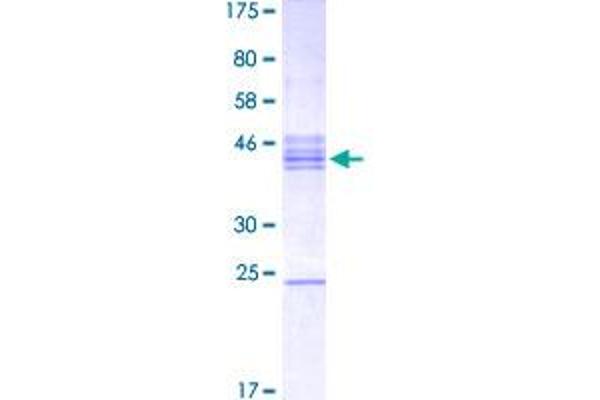 NEUROD6 Protein (AA 191-290) (GST tag)