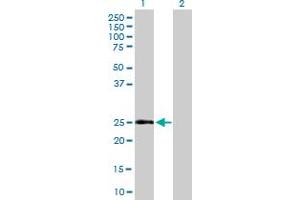 Western Blot analysis of CD69 expression in transfected 293T cell line by CD69 MaxPab polyclonal antibody. (CD69 antibody  (AA 1-199))