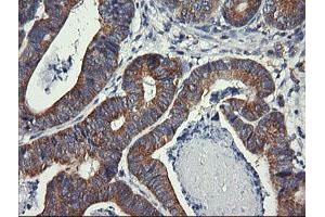 Image no. 2 for anti-Dynamin 1-Like (DNM1L) antibody (ABIN1497872) (Dynamin 1-Like antibody)