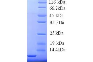 FCER1G Protein (AA 45-86, Cytoplasmic Domain, Cytosolic) (His tag)