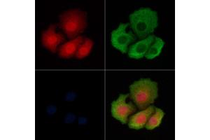 ABIN6261142 and ABIN6269146 staining Hela cells by IF/ICC.