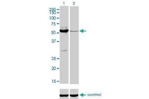 Western blot analysis of MUTYH over-expressed 293 cell line, cotransfected with MUTYH Validated Chimera RNAi (Lane 2) or non-transfected control (Lane 1). (MUTYH antibody  (AA 436-535))