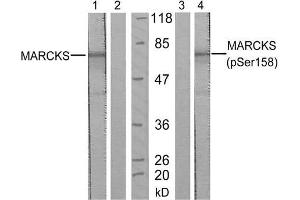 Western blot analysis of extract from starved NIH/3T3 cells, using MARCKS (Ab-158) antibody (E021285, Lane 1 and 2) and MARCKS (phospho-Ser158) antibody (E011293, Lane 3 and 4). (MARCKS antibody  (pSer158))