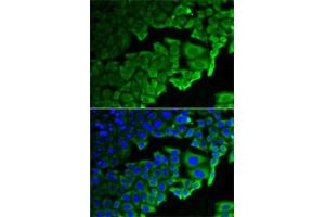 Immunofluorescence analysis of HeLa cells using RPLP0 antibody (ABIN6128686, ABIN6147163, ABIN6147165 and ABIN6221205).