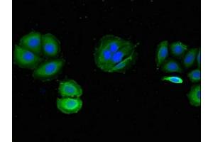 Immunofluorescent analysis of A549 cells using ABIN7175730 at dilution of 1:100 and Alexa Fluor 488-congugated AffiniPure Goat Anti-Rabbit IgG(H+L) (WDR19 antibody  (AA 45-226))