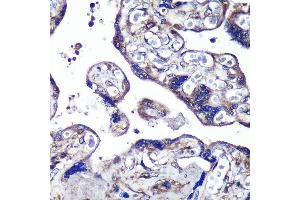 Immunohistochemistry of paraffin-embedded Human placenta using PASK Rabbit pAb (ABIN6128413, ABIN6145248, ABIN6145249 and ABIN6224850) at dilution of 1:100 (40x lens). (PASK antibody  (AA 1194-1323))