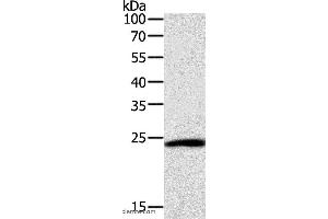 Western blot analysis of Hela cell, using SNAP25 Polyclonal Antibody at dilution of 1:400 (SNAP25 antibody)