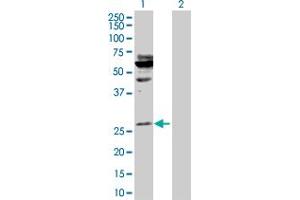 Western Blot analysis of HOXA5 expression in transfected 293T cell line by HOXA5 MaxPab polyclonal antibody. (HOXA5 antibody  (AA 1-270))
