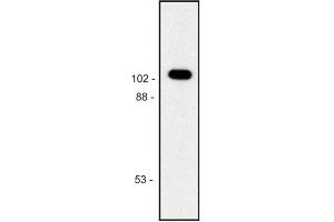 Western blot of purified E. (GLB1 antibody)
