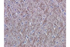 Immunohistochemical staining of rat brain tissue using anti-VEGF antibody  A. (Recombinant VEGF antibody)