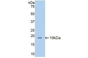 Detection of Recombinant ICAM1, Mouse using Polyclonal Antibody to Intercellular Adhesion Molecule 1 (ICAM1) (ICAM1 antibody  (AA 328-465))