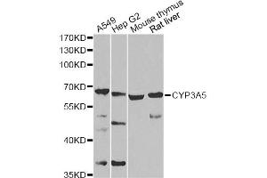 Western blot analysis of extracts of various cell lines, using CYP3A5 Antibody (ABIN2736613) at 1:1000 dilution. (CYP3A5 antibody)