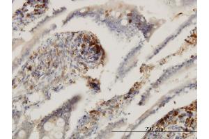 Immunoperoxidase of monoclonal antibody to ENTPD6 on formalin-fixed paraffin-embedded human small Intestine. (ENTPD6 antibody  (AA 386-484))