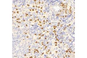 Immunohistochemistry (Paraffin-embedded Sections) (IHC (p)) image for anti-Interleukin 23 Receptor (IL23R) antibody (ABIN7074355)