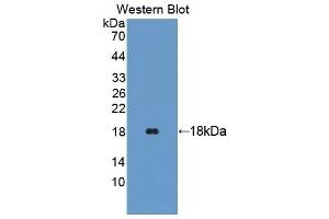 Detection of Recombinant TRAPPC2, Human using Polyclonal Antibody to Trafficking Protein Particle Complex 2 (TRAPPC2) (TRAPPC2 antibody  (AA 1-140))