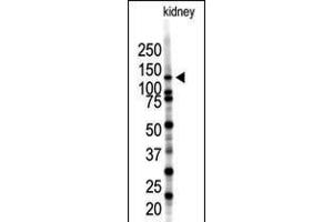 Western blot analysis of SENP7 polyclonal antibody in mouse kidney tissue lysate (35ug/lane). (SENP7 antibody  (C-Term))