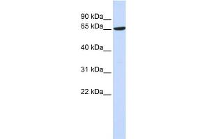 WB Suggested Anti-ADAM9 Antibody Titration:  0. (ADAM9 antibody  (Middle Region))
