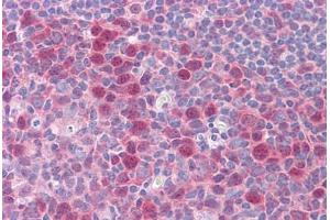 Human Tonsil: Formalin-Fixed, Paraffin-Embedded (FFPE) (Exportin 2 antibody  (AA 872-972))
