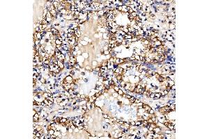 IHC analysis of Glycogen synthase 1/GYS1 using anti-Glycogen synthase 1/GYS1 antibody (ABIN7602155). (Glycogen Synthase 1 antibody  (AA 60-640))