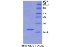 SDS-PAGE analysis of Rat Matrix Gla Protein. (MGP Protein)