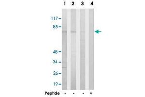 Western blot analysis of extracts from HeLa cells (Lane 1), Jurkat cells (Lane 2) and COLO 205 cells (Lane 3 and lane 4), using HKR1 polyclonal antibody .