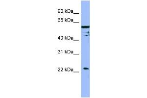 WB Suggested Anti-FAIM  Antibody Titration: 0. (FAIM antibody  (Middle Region))
