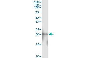 Immunoprecipitation of N6AMT1 transfected lysate using anti-N6AMT1 MaxPab rabbit polyclonal antibody and Protein A Magnetic Bead , and immunoblotted with N6AMT1 MaxPab mouse polyclonal antibody (B01) . (N6AMT1 antibody  (AA 1-186))