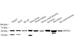 BTNL2 antibody