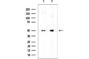 anti-Aspartyl Aminopeptidase (DNPEP) (Internal Region) antibody