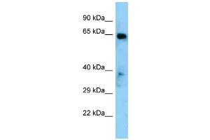 Western Blotting (WB) image for anti-Eyes Absent Homolog 1 (EYA1) (Middle Region) antibody (ABIN2779641) (EYA1 antibody  (Middle Region))