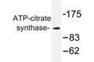 Western blot analysis of ATP-citrate synthase antibody in extracts from COS7 cells. (ACLY antibody)