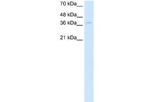 WB Suggested Anti-CTDSPL Antibody Titration:  0. (CTDSPL antibody  (N-Term))