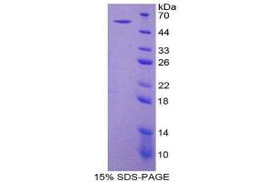 SDS-PAGE (SDS) image for Ectonucleoside Triphosphate diphosphohydrolase 1 (ENTPD1) (AA 213-452) protein (His tag,GST tag) (ABIN1879474) (CD39 Protein (AA 213-452) (His tag,GST tag))