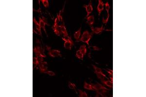 ABIN6268687 staining HeLa by IF/ICC. (IL2 Receptor beta antibody  (N-Term))