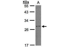 WB Image Sample (30μg whole cell lysate) A:H1299 12% SDS PAGE antibody diluted at 1:1000 (RGS2 antibody)