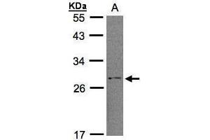 WB Image Sample (30μg whole cell lysate) A:H1299 12% SDS PAGE antibody diluted at 1:1000