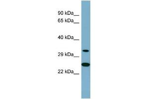 Western Blotting (WB) image for anti-Protein Kinase, AMP-Activated, beta 2 Non-Catalytic Subunit (PRKAB2) (Middle Region) antibody (ABIN2786810)