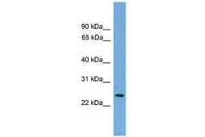 Image no. 1 for anti-Proteasome (Prosome, Macropain) Activator Subunit 2 (PA28 Beta) (PSME2) (AA 143-192) antibody (ABIN6746452) (PSME2 antibody  (AA 143-192))