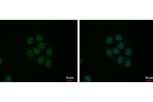 ICC/IF Image SFRS9 antibody detects SFRS9 protein at nucleus by immunofluorescent analysis. (SFRS9 antibody  (Center))