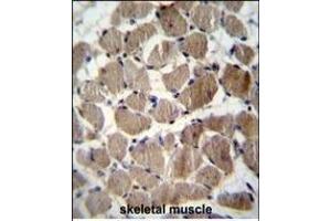 COCH Antibody (Center) (ABIN656833 and ABIN2846042) immunohistochemistry analysis in formalin fixed and paraffin embedded human skeletal muscle followed by peroxidase conjugation of the secondary antibody and DAB staining.