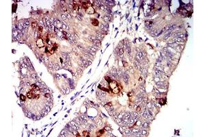 Immunohistochemistry (IHC) image for anti-T-cell surface glycoprotein CD1c (CD1C) (AA 18-302) antibody (ABIN5611307)