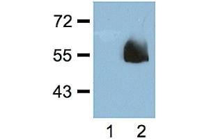 1:1000 (1 ug/ml) antibody dilution probed against HEK 293 cells transfected with HA-tagged protein vector; unstransfected (1) and transfected (2). (Hemagglutinin antibody)