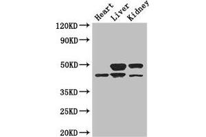 Western Blot Positive WB detected in: Mouse heart tissue, Mouse liver tissue, Mouse kidney tissue All lanes: TGIF1 antibody at 3 μg/mL Secondary Goat polyclonal to rabbit IgG at 1/50000 dilution Predicted band size: 44, 30, 32, 28 kDa Observed band size: 44, 50 kDa (TGIF1 antibody  (AA 8-375))