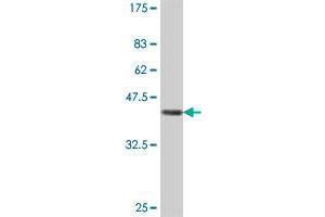 Western Blot detection against Immunogen (37 KDa) . (EPM2AIP1 antibody  (AA 508-606))