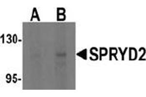 Western blot analysis of SPRYD2 in rat brain tissue lysate with SPRYD2 antibody at (A) 1 and (B) 2 μg/ml (CMYA5 antibody  (C-Term))