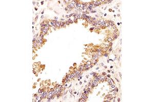 Immunohistochemical analysis of paraffin-embedded H. (ZRSR2 antibody  (C-Term))