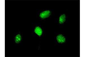 Immunofluorescence of monoclonal antibody to HOXA5 on HeLa cell. (HOXA5 antibody  (AA 171-270))